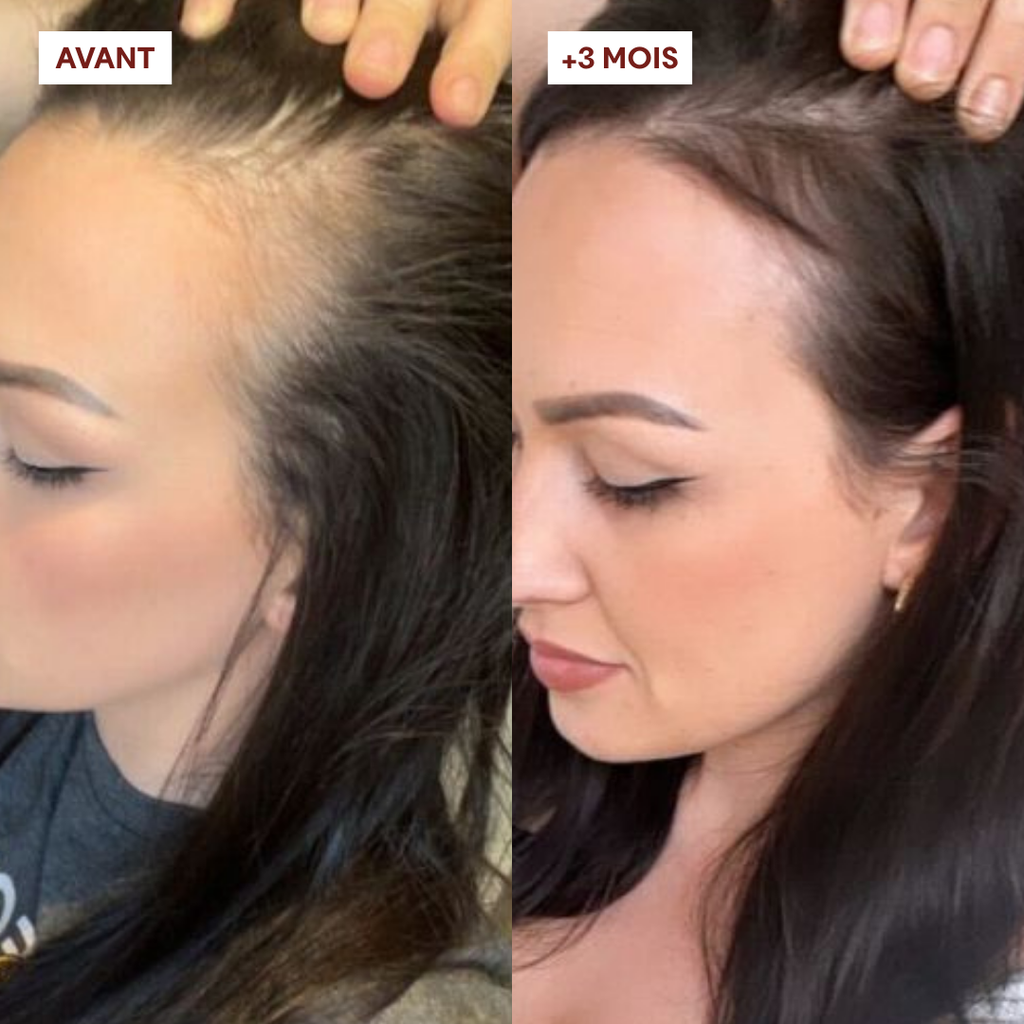 Gommage Actif Anti-Chute