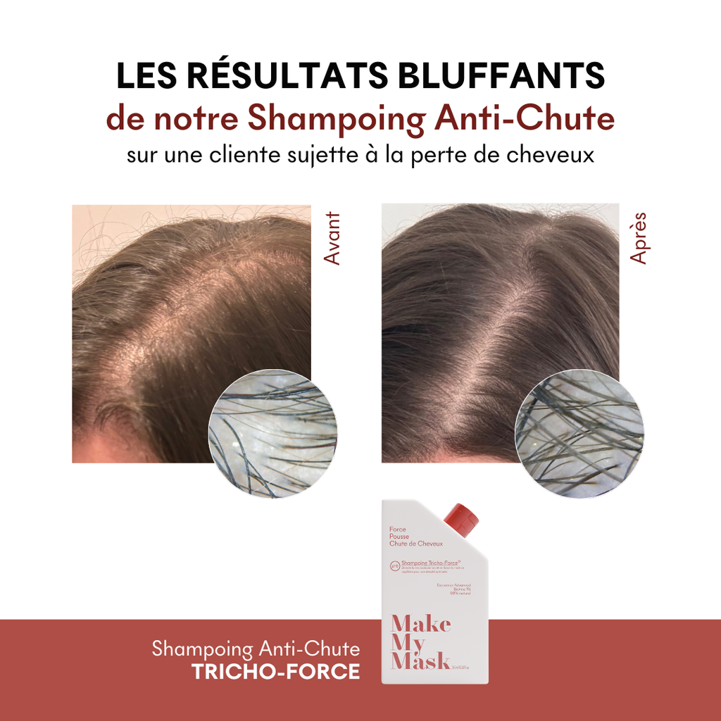 Shampoing Anti-Chute Tricho-Force pH5