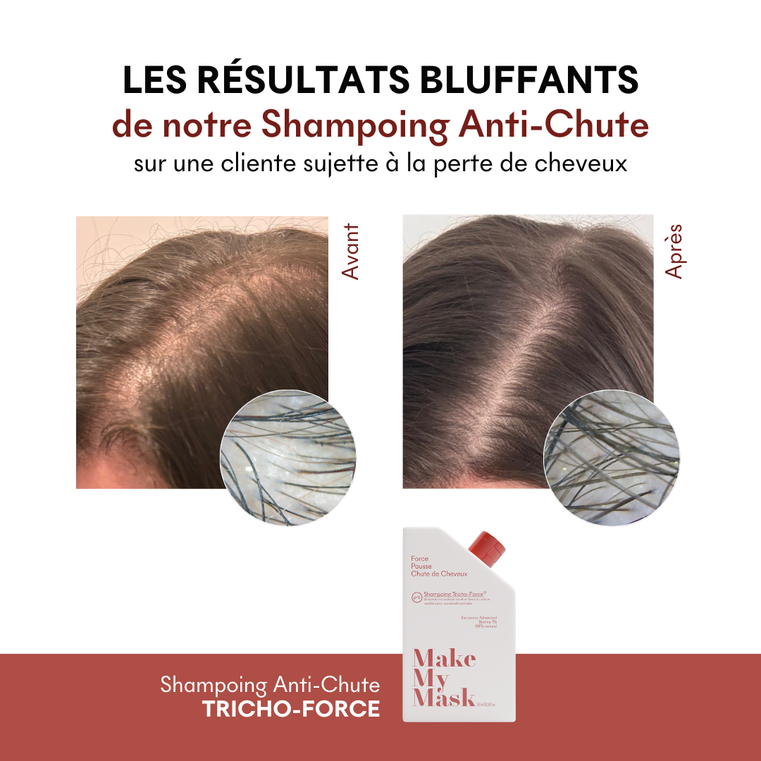 Shampoing Anti-Chute Tricho-Force pH5