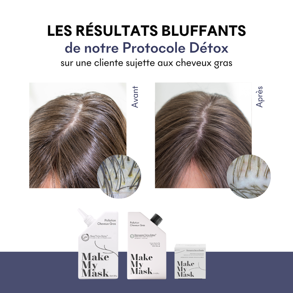 Shampoing Tricho-Détox pH5