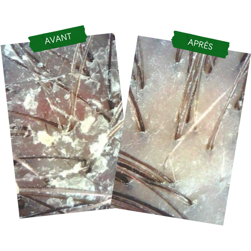 Concentré Anti-PSO & Plaques