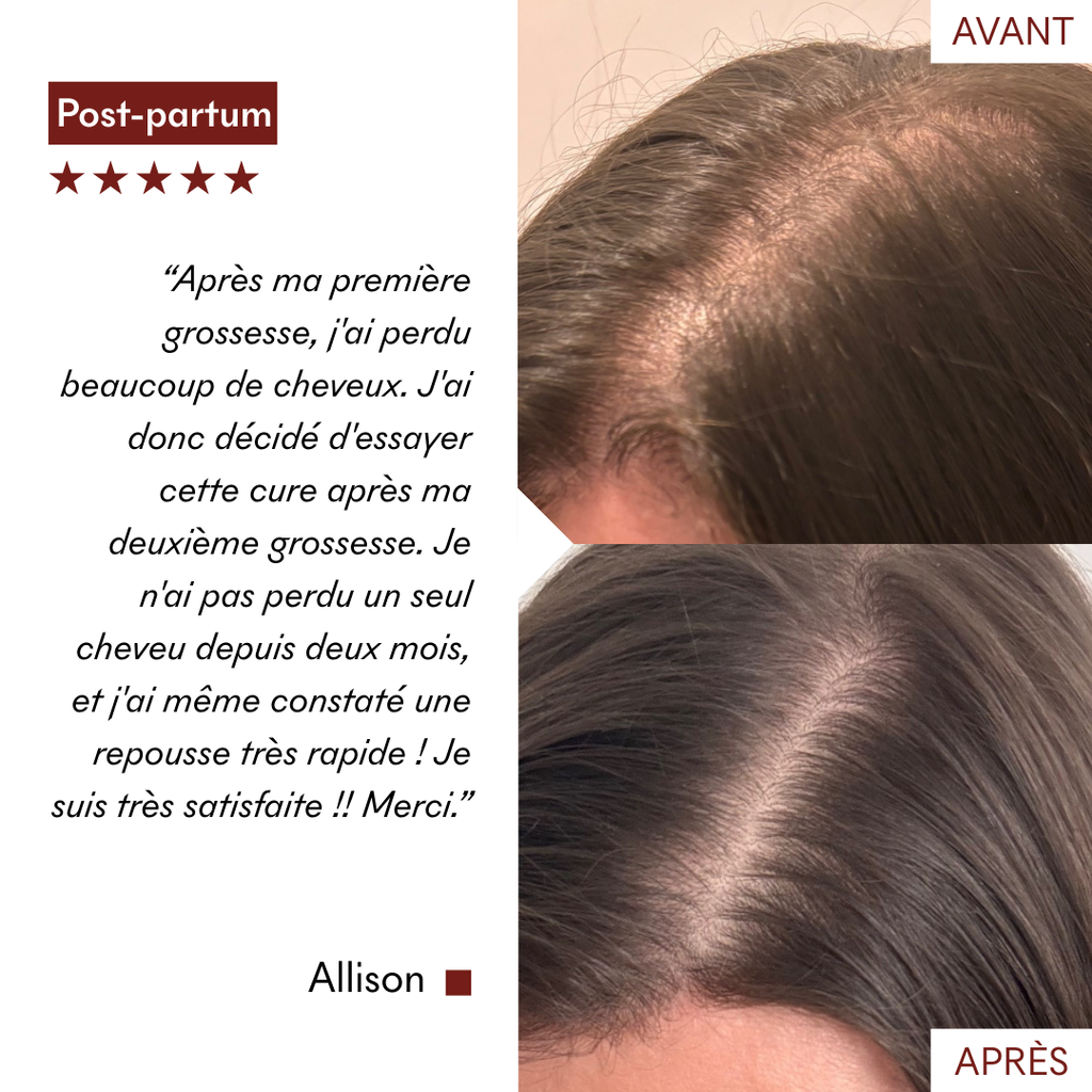 Sérum Anti-Chute Tricho-Boost